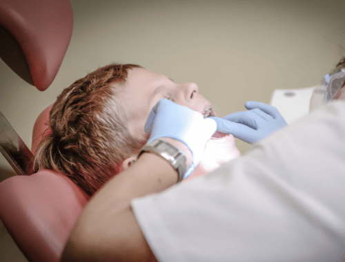 Pečatenie mliečných a trvalých zubov